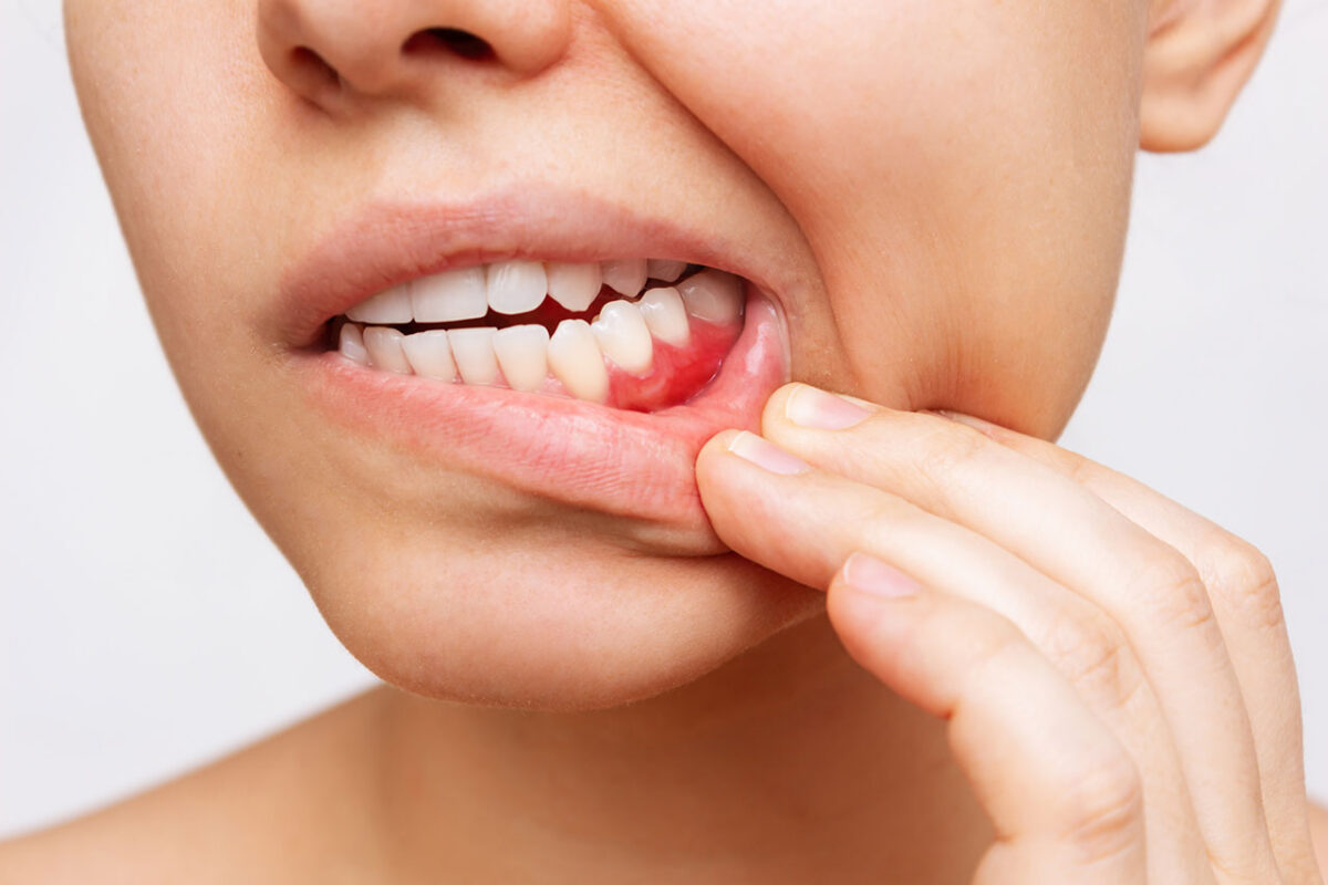 Periodontal Treatments in Pagosa Springs: Why Healthy Gums Deserve Attention